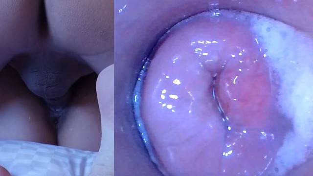 Monster Wet Pussy Cams - Pussy cum, Pussy cam!! (Endoscope inside creampied pussy) watch online